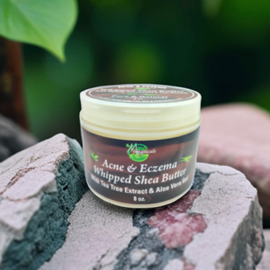 Acne & Eczema Whipped Shea Butter